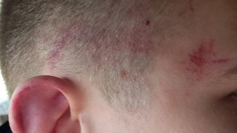 UHAPŠEN ALBANAC KOJI JE NAPAO SRPSKOG DEČAKA Osumnjičenom određeno zadržavanje, ni reči o ostalim napadačima