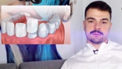 NE KORISTITE OVE PASTE ZA ZUBE Stomatolog Nikola tvrdi, "Vrlo su nezdrave, a postoji i nešto još štetnije"