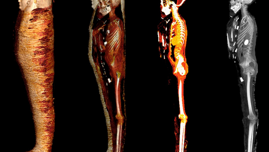 ŠOK OTKRIĆE U EGIPTU Misteriozna mumija deteta sa zlatnim srcem