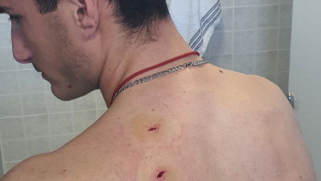 ALBANCI IZBOLI SRPSKOG MLADIĆA Oglasio se Vučić: Ovo je rezultat mržnje koju promoviše Kurtijev režim (FOTO)