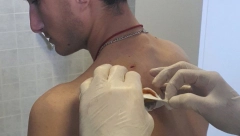 JEDAN GA JE DRŽAO, DRUGI GA JE UBADAO NOŽEM Privedeni Albanci zbog napada na Srbina na Kosmetu