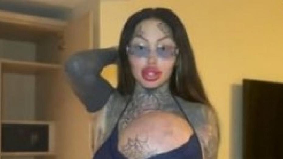 ZASTRAŠUJUĆE Eksplodiralo joj 10 kilograma implanta u lice, Marija pokazala unakaženo telo, "da li je ovo kraj", pitaju je pratioci