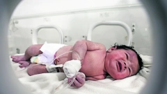 ČUDO NAD ČUDIMA! Živa beba pupčanom vrpcom ostala vezana za mrtvu majku!