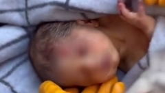 BEBA STARA 20 DANA SPASENA IZ RUŠEVINA U ruci držala pramen kose svoje majke (VIDEO)