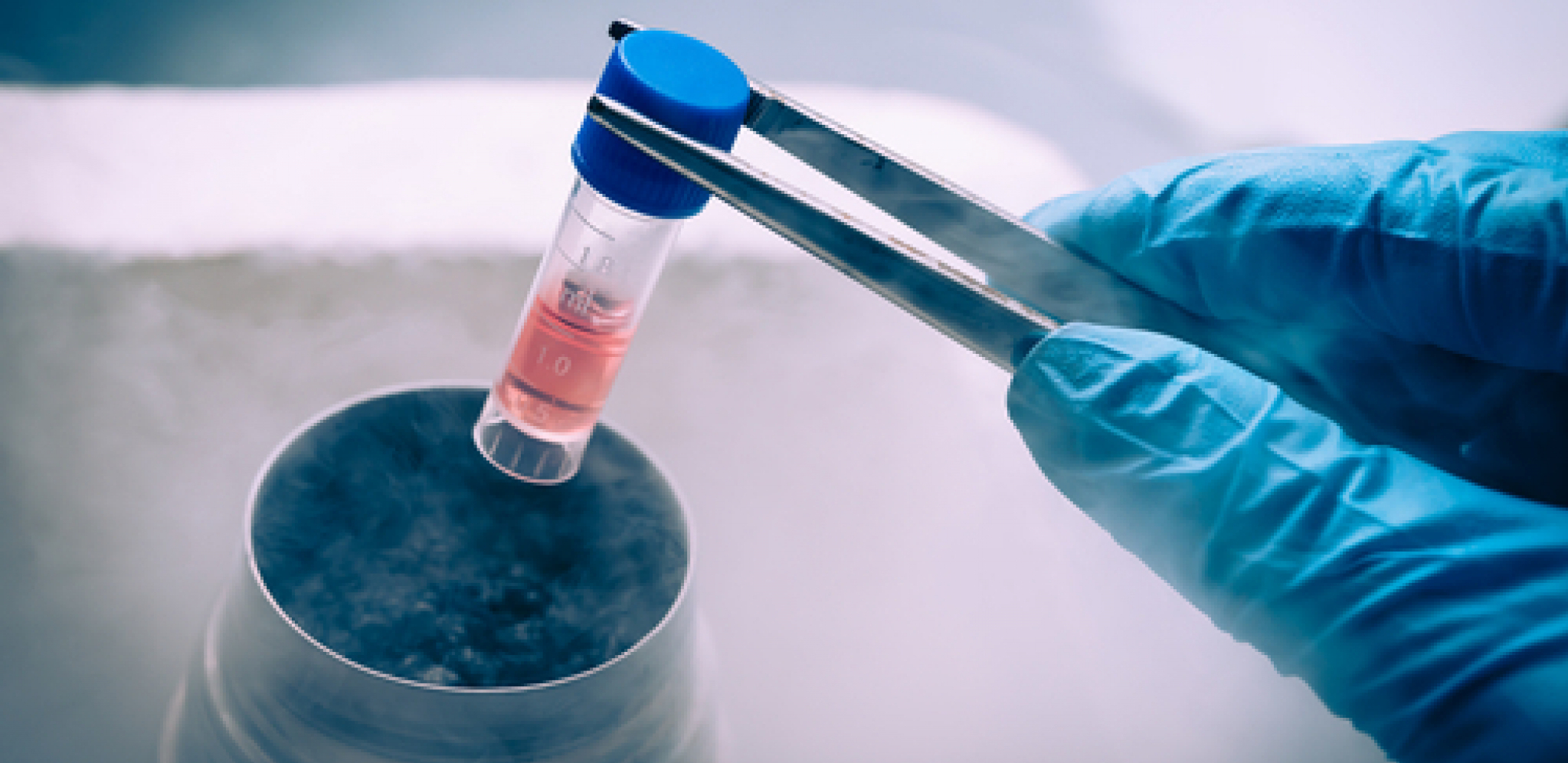 NAUČNICI OTKRILI Što smo stariji, imamo više zombi ćelija u telu