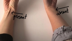 URADITE OVAJ TEST SA PRSTIMA Proverite da li spadate među 14 odsto ljudi koji NEMAJU ovu tetivu na ruci (VIDEO)