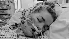 SVE JE POČELO KAO GRIP Borila se za život 66 dana, a onda je ostala i bez obe noge zbog ove infekcije