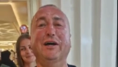 ĐANI U OPEKOTINAMA Pevač zakukao na sav glas, fanovi u čudu, svi se pitaju šta mu se dogodilo (VIDEO)