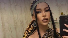 ŠOKANTNO KAKO JE ELENA KITIĆ IZGLEDALA PRE SVIH OPERACIJA Ostaćete bez teksta, da li je moguće ovo?! (FOTO)