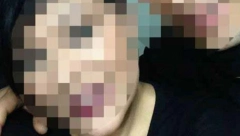 POLICIJA U STANU ZATEKLA STRAVIČNU SCENU! Žena iz Jagodine umrla usled batina - sumnja se da je partner šutirao i pesničio