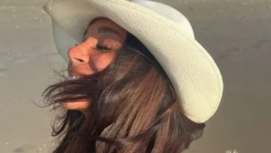 PEVAČICA IZGORELA, LICE JOJ U OPEKOTINAMA Oglasila se i pokazala šta se desilo, pa se požalila svojim pratiocima! (FOTO)