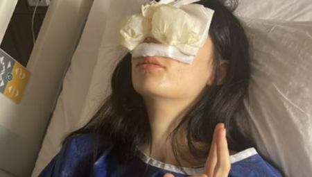 ŠOKIRALA FANOVE  Uki Ku objavila fotografije iz bolničkog kreveta, za novi nos je iskeširala 7.000 evra, a sada je progovorila o operaciji grudi: Imam ožilke!