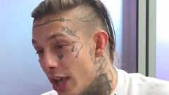 PRETUČEN FRAJ PUJAS? Bivši zadrugar objavio uznemirujuću fotku, masnica ispod oka sve zabrinula (FOTO)