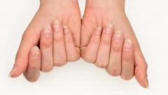 ŠTA ZNAČE BELE MRLJE NA VAŠIM NOKTIMA? Evo kada treba da se zabrinete