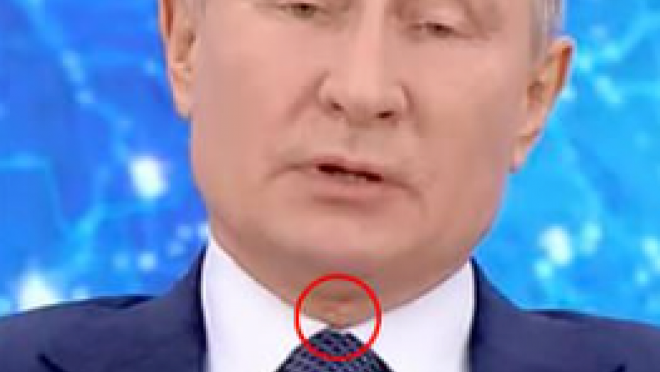 ŠTA JE SA PUTINOM? KAKAV JE TO OŽILJAK NA VRATU? Nova fotografija ruskog lidera obišla svet!