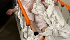 POTRESNA SCENA U BOLNICI U SISKU! Dve starice smeštene na jednom krevetu (FOTO)