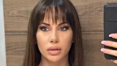 OVO NIKO NIJE OČEKIVAO Aleksandra Tadić otkrila zbog čega je operisala nos, razlog je bizaran