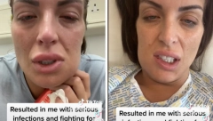 JEDVA JE IZVUKLA ŽIVU GLAVU ZBOG GREŠKE ZUBARA Želela je samo Holivudski osmeh, a završila sa ozbiljnom infekcijom (FOTO)