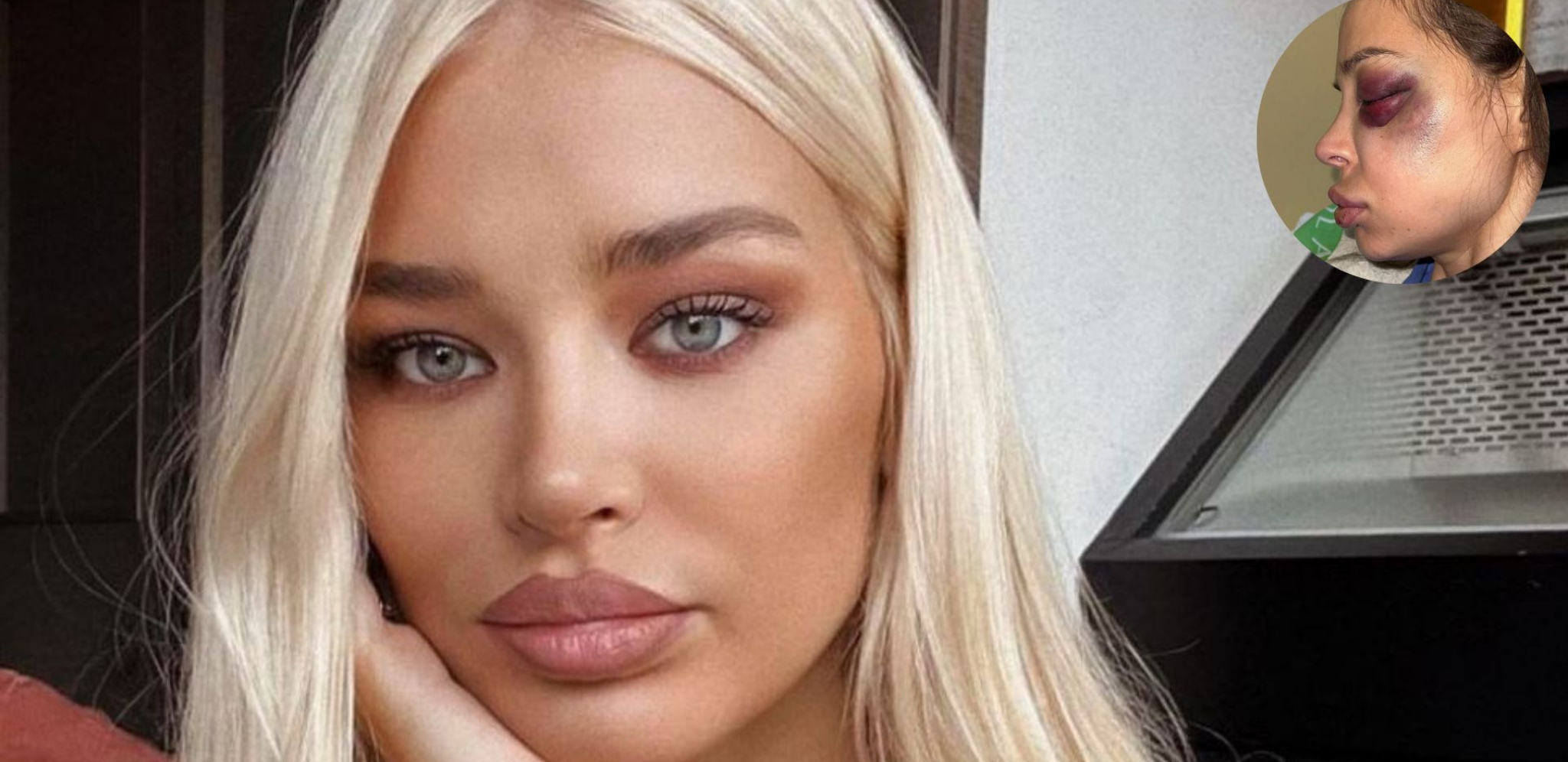 SOFIJA PRUŽILA PODRŠKU ŠAVIJI! Manekenka se oglasila i poslala snažnu poruku, svima je ovim gestom zapušila usta (FOTO)
