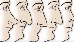 OBLIK NOSA ODAJE KARAKTER Možete na prvi pogled poznati švalera, a i onog ko će se obogatiti