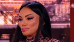 "KAŽU DA SAM NAKAZA. ALI MENI JE OVAKO SUPER" Tamara Đurić se jedva smeje nakon poslednje operacije, a sada otkrila koji je njen jedini porok! (FOTO)