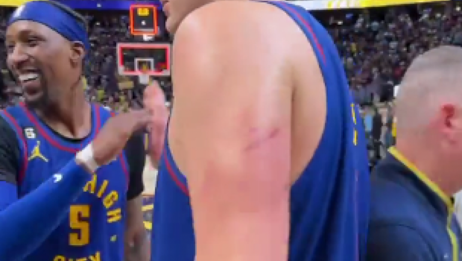 ZAŠTO SU NIKOLINE RUKE U RANAMA? Sve je priznao: Jedina taktika je prebiti Jokića - "Samo sam ga tukao"