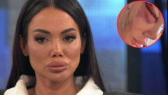 ISPLIVALE JEZIVE FOTOGRAFIJE! Tamara Đurić u modricama, lice joj izobličeno od podliva, javnost uznemirena (FOTO)