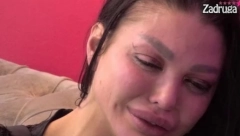 "POGLEDAJ, ĆELAVA SAM" Maja Marinković očajna posle nasilja Anđele Đuričić, pala u depresiju, pa moli za pomoć!