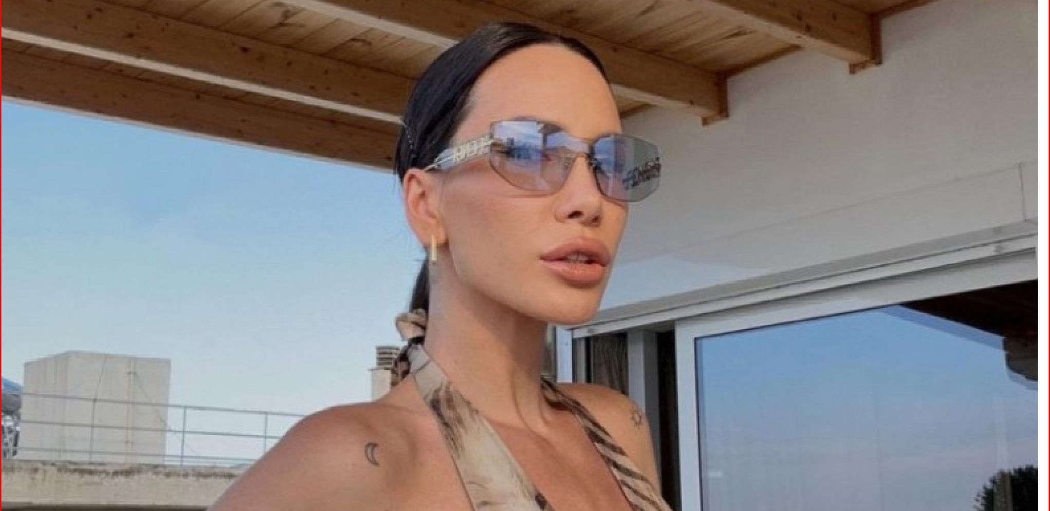 NE LIČI NA SEBE Nikolija se izbotoksirala, pa se usnimila bez trunke šminke! (FOTO)