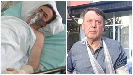 Devenport za prištinske medije o žrtvama, ni reči o 52 ranjenih Srba