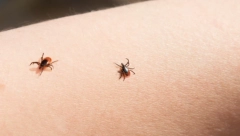 ŠTA KADA NA KOŽI NAĐETE KRPELJA? Ovo je siguran način za uklanjanje