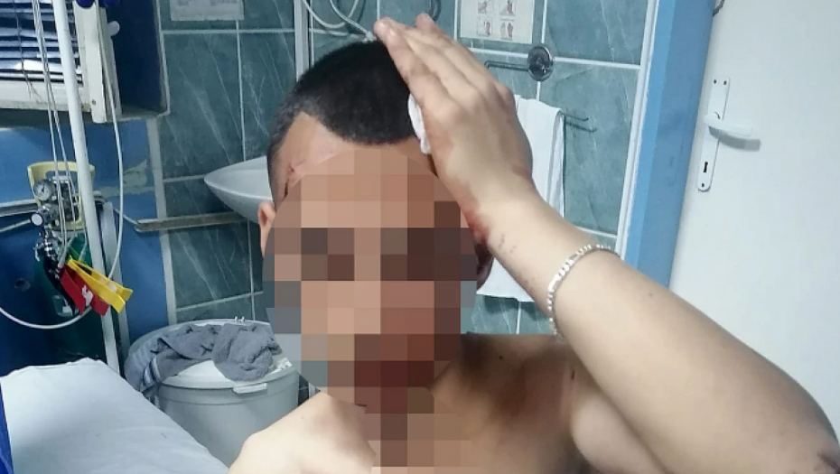 MISLIO SAM DA MI JE SIN MRTAV Dečak brutalno pretučen u Smederevu: Od srca nisam mogao da bežim, stigli su me... (FOTO)