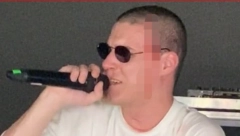 REPERU RAZBILI GLAVU NA NASTUPU Počeo da je krvari na sceni, pogledajte šta je uradio nakon incidenta! (VIDEO)
