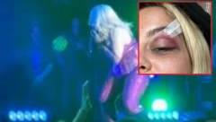 OGLASILA SE ALBANSKA PEVAČICA KOJU SU POGODILI TELEFONOM U GLAVU ZBOG POKAZIVANJA DVOGLAVOG ORLA Ovo je pokazala na Instagramu