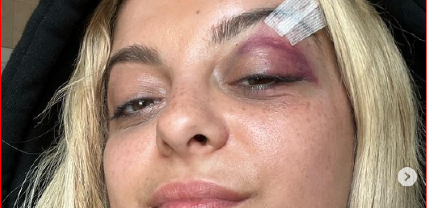 ALBANKA DOBILA TELEFON U GLAVU ZBOG DVOGLAVOG ORLA Pop zvezda Bibi Reksa promovisala ideju velike Albanije na koncertu