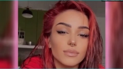 BRESKVICA U LOŠEM ZDRAVSTVENOM STANJU Pevačica se hitno oglasila, pa otkrila šta se dogodilo: Dobila sam drvo u glavu!