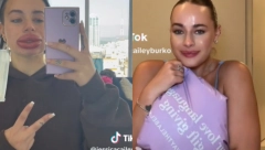 DA LI JE OVO ISTA OSOBA? Dobila je besplatno uvećavanje usana, a onda joj se život pretvorio u pakao