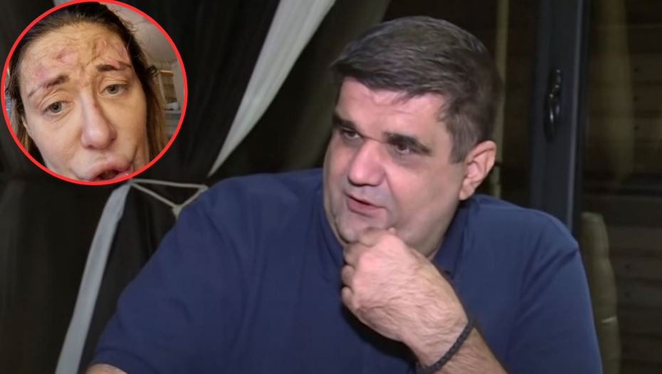 U PITANJU JE SINTETIČKA DROGA... Saša Mirković izneo jezive detalje, zbog ovoga su se Ani pojavile rane na licu: Po ceo dan nosi flašicu sa sobom!