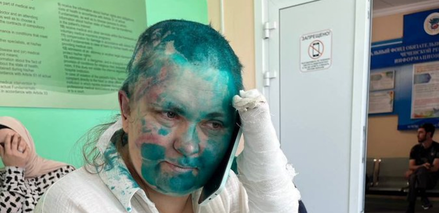 IZVUKLI JE IZ KOLA, A ONDA SU IZVADILI MOTKU Detalji napada na rusku novinarku, Čečeni joj ovo nisu oprostili