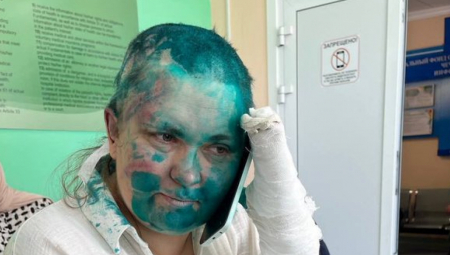OBRIJALI JOJ GLAVU, ZALILI JE FARBOM! Čečeni uhvatili prozapadnu novinarku, slike zapalile mreže! (FOTO)