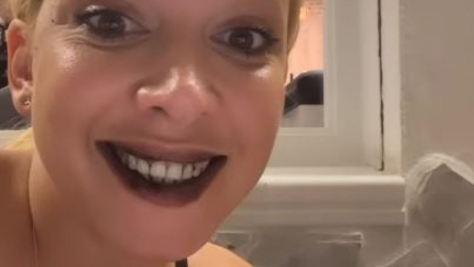 ŠOK Milica Todorović priznala: "MOZAK MI JE OTEČEN", pa otkrila šta joj se dogodilo