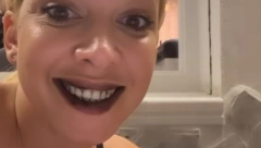 ŠOK Milica Todorović priznala: "MOZAK MI JE OTEČEN", pa otkrila šta joj se dogodilo