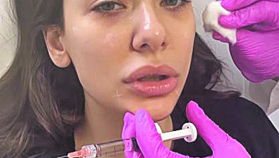 ISKRENA Sanja Vučić priznala: Ne radim filere, ali ovo je moja zamena za njih!