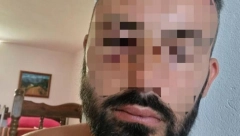 Mladić iz Srbije potvrdio da je pretučen u Sutomoru: „Polomljen mi je nos, zašivena brada…“