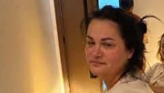 POLOMLJENA Jana prikazala sebe u šokantnom izdanju, pa otkirla razlog zbog kog tako izgleda