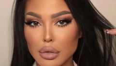 MAJA OTIŠLA POD NOŽ! Marinkovićeva otkrila koliko je platila operaciju zadnjice, od cene će vam se zavrteti u glavi!