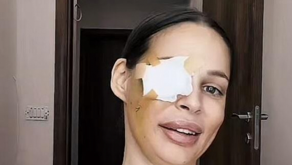 GOLO TELO PREKRILA ŠLAGOM Nataša Šavija nakon operacije pozirala kao od majke rođena, javnost u šoku (FOTO)