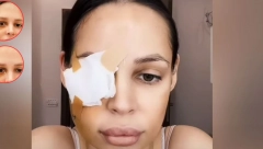 KAPAK I OKO VRAĆENI U NORMALU Evo kako Nataša Šavija izgleda nakon poslednje operacije (FOTO)