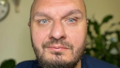 GEJ AKTIVISTA SE BORI SA KANCEROM, IMA JAKU PORUKU ZA SVE "Pet dana raskrvarenog kapilara, i imam da vam kažem samo jedno... "