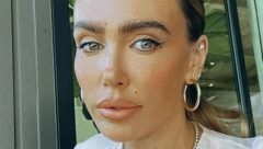 „SREĆNA SAM ŠTO SAM ŽIVA“ Drama bogate naslednice Petre Eklston, zbog greške zubara doživela horor